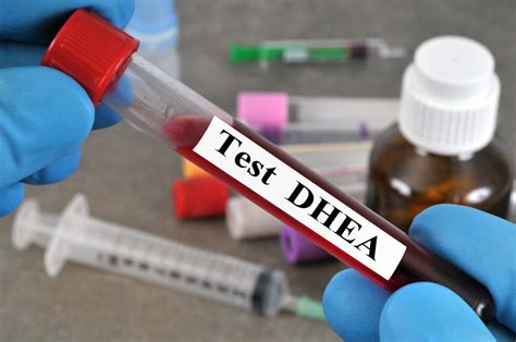 analyzer lab to do dhea-s|dheas test for female.